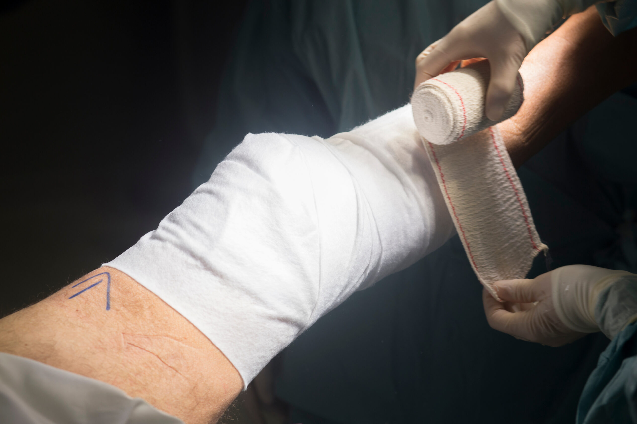Knee surgery nurse bandaging