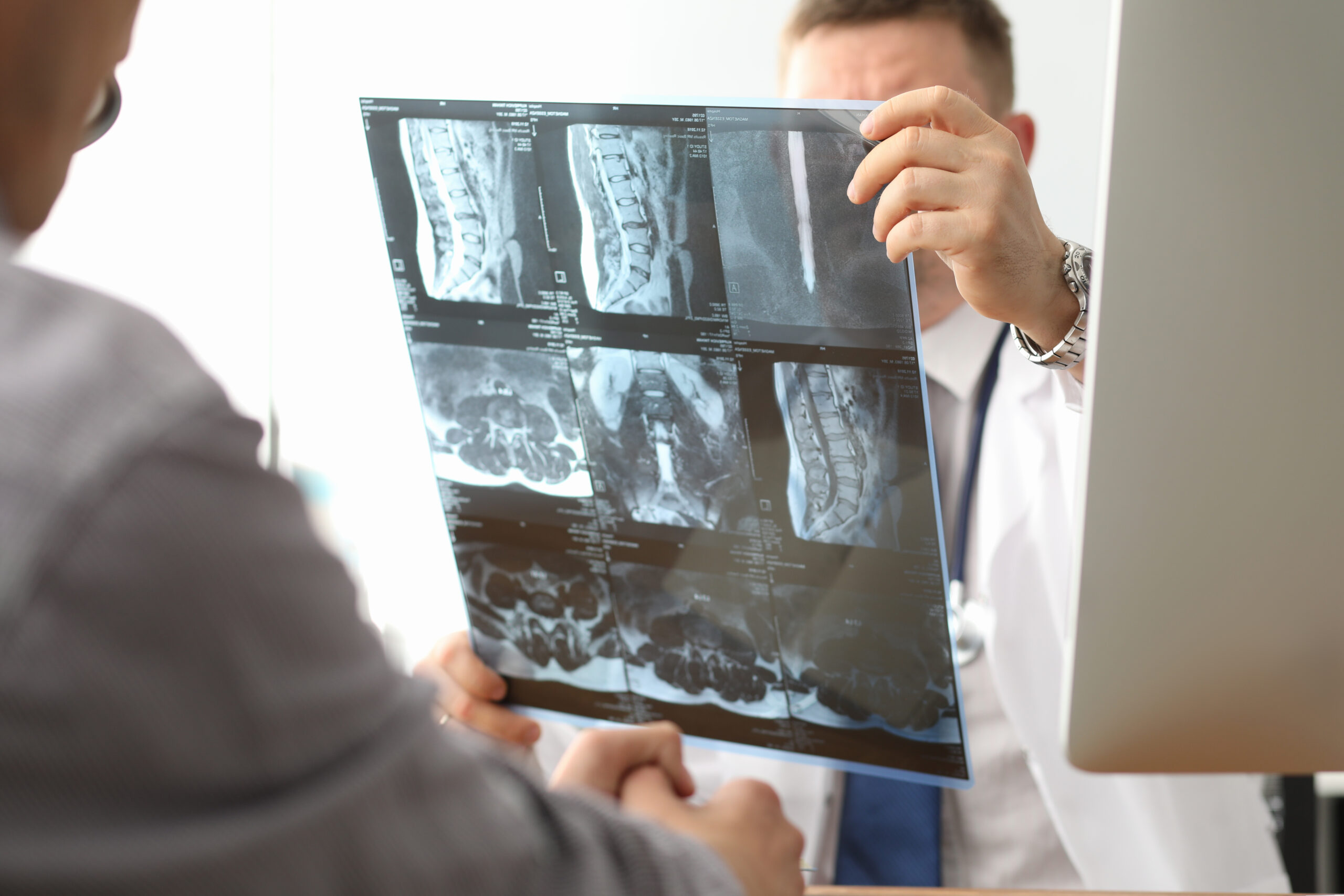 Reviewing Spine Fracture X-Rays
