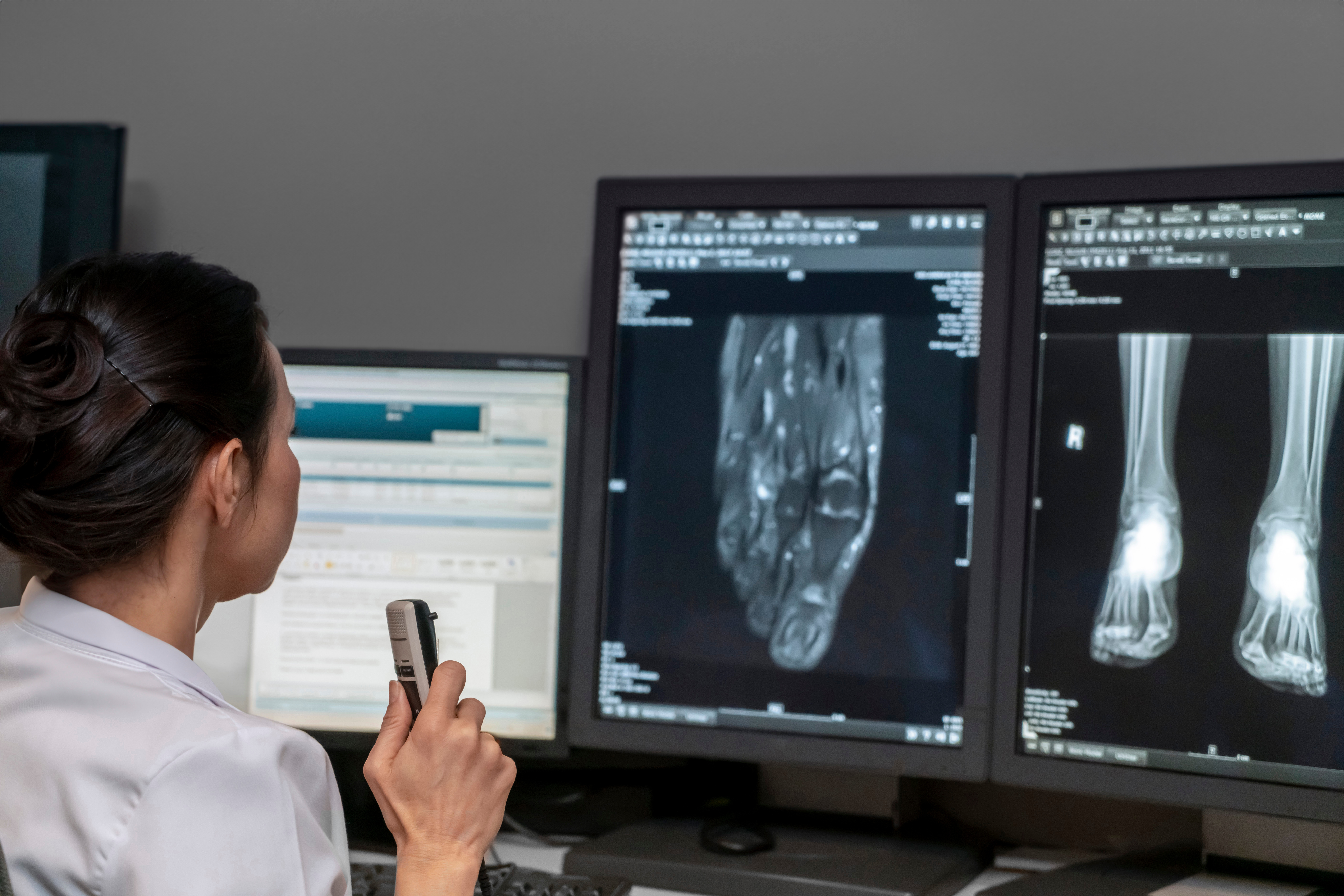 radiology doctor examines foot, ankle x-ray, mr image and reports with microphone looking computer screen, X-ray analysis room reading X-rays of a heel, toe and other parts of the body.